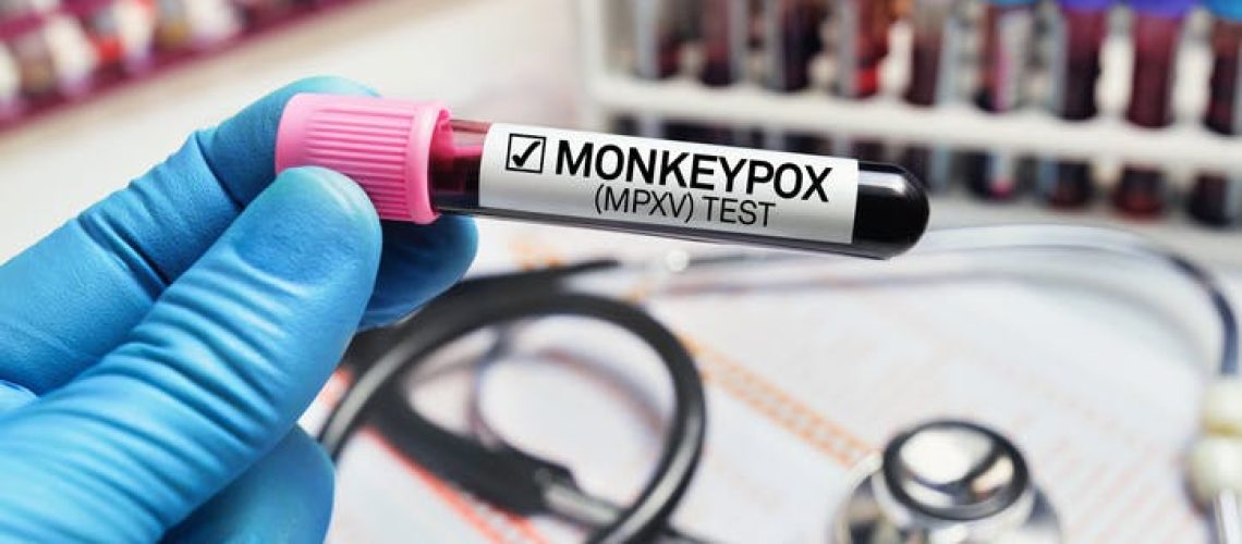 Tout savoir sur la variole du singe (Mpox) : transmission, vaccin, symptômes…